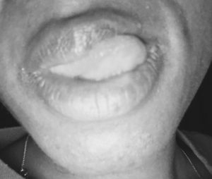 Lip licking